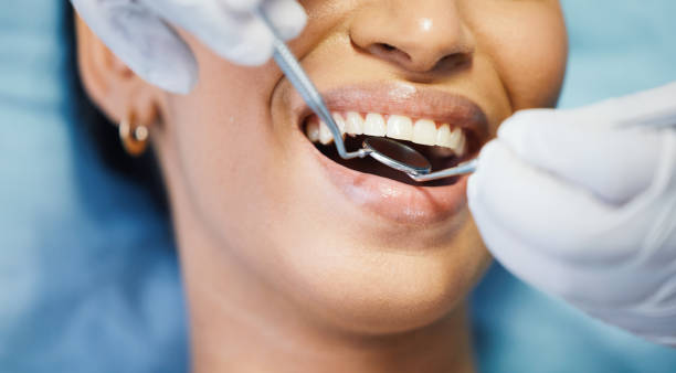 Best Emergency Dental Care for Broken or Chipped Teeth in Hazel Green, AL