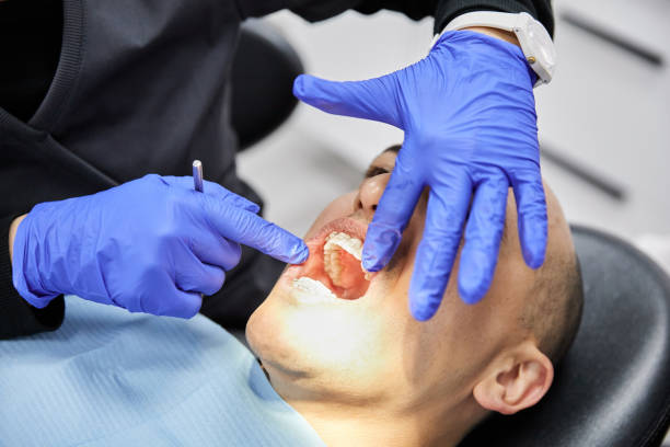 Best Emergency Tooth Extraction in Hazel Green, AL