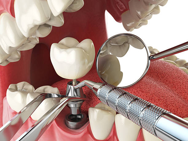 , AL Emergency Dentist Company